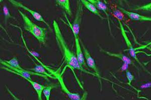 Científicos Argentinos obtienen células de retina a partir de la grasa