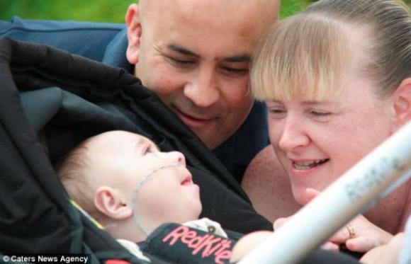 Tienen que resucitar a su bebé 5 veces al día, una historia de dedicación y amor