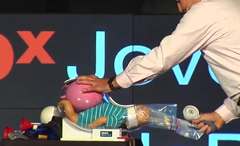 Se populariza en el mundo invento argentino extractor de bebés