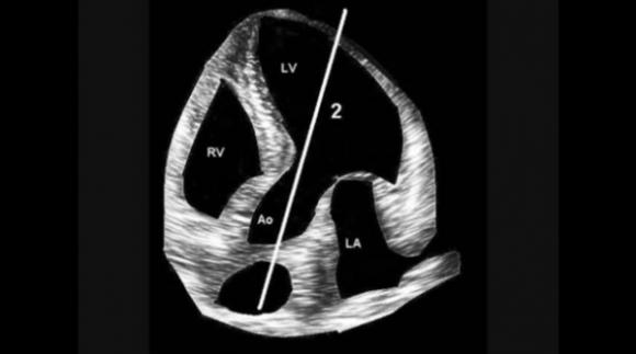 Medico Argentino desarrolla un nuevo método de auscultación cardíaca innovando en el procedimiento luego de 200 años‏