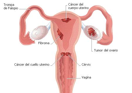 Nueva prueba detecta el cáncer de ovario en sus fases iniciales