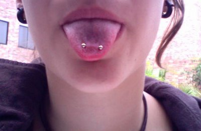 El piercing en la lengua conlleva riesgos muy peligrosos
