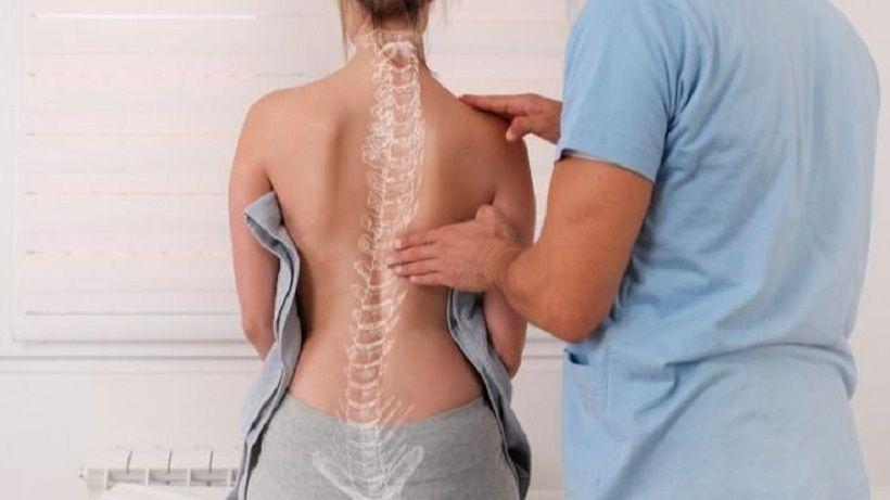 Escoliosis: Cuáles son las señales que deben motivar la consulta