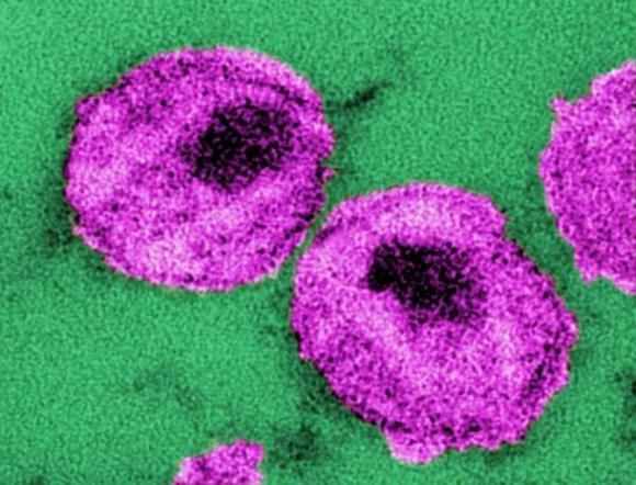 Técnica comparable a la de los misiles guiados, para destruir virus del SIDA dentro del cuerpo