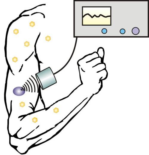 Control de azúcar en sangre mediante nanopartículas y ultrasonido