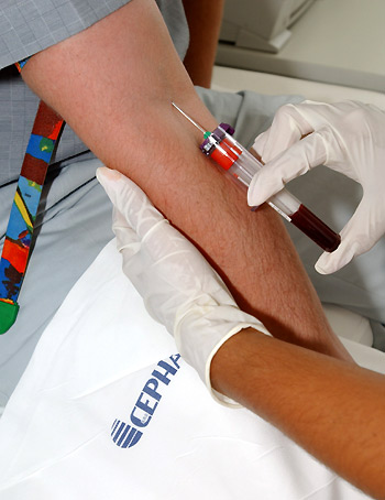 Un analisis de sangre detectaría enfermedad cardíaca en personas sin síntomas