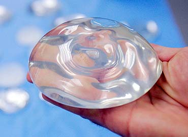 Según la FDA los implantes de mama no son para siempre