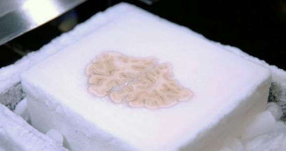 Crean un mapa en 3D de un cerebro amnésico para estudiar la memoria