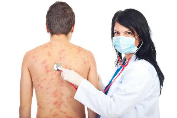 Las enfermedades de la piel más frecuentes del viajero