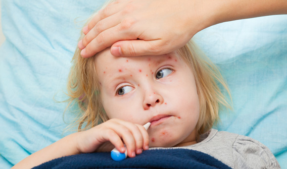 Las muertes por sarampión disminuyeron notablemente