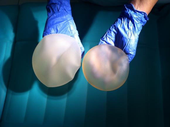 Retiran del mercado las prótesis mamarias no implantadas “Cereform”