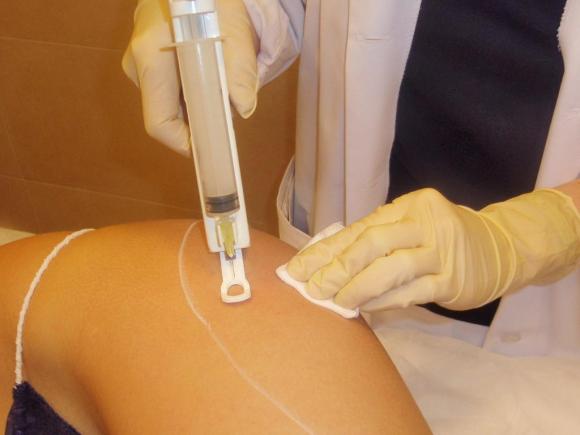 Mesoterapia facial y corporal