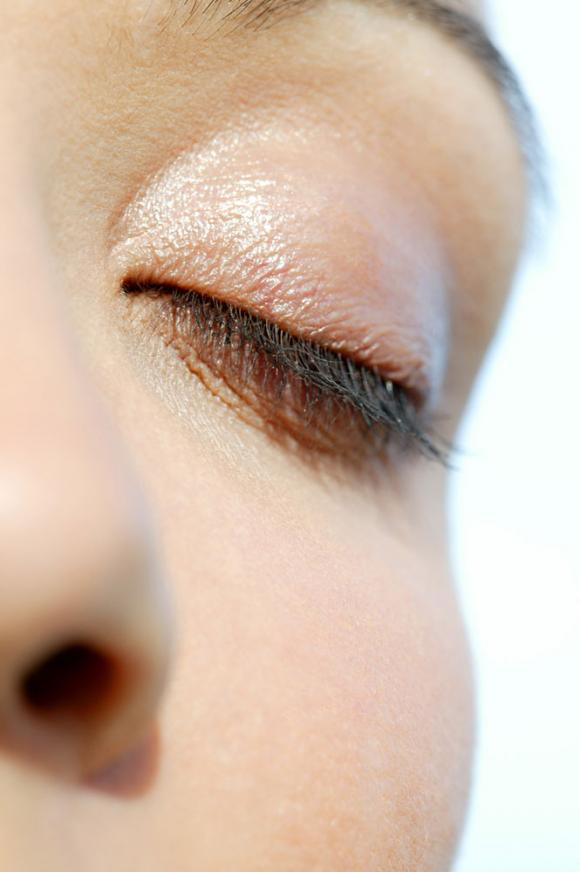 Blefaroplastia