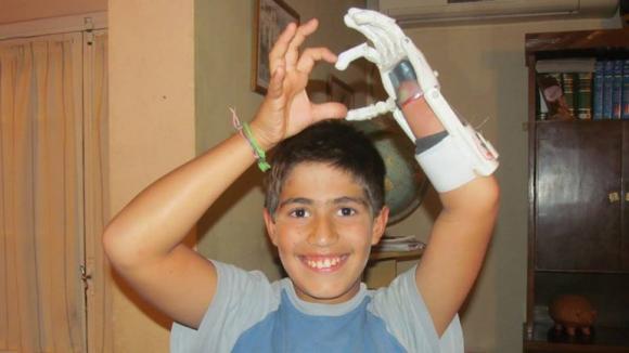 Jóvenes argentinos desarrollaron una prótesis con una impresora 3D
