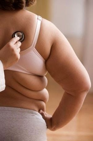 La obesidad aumentaría el riesgo de muerte por cáncer de mama