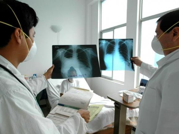 Piden que se frene la tuberculosis mutirresistente