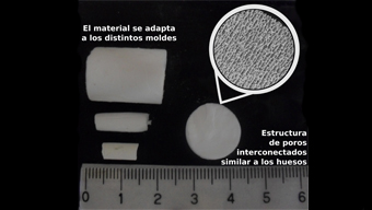 Cientificos Argentinos reconstruyen el tejido oseo a partir del biovidrio