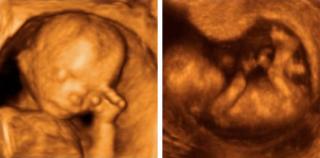 Estudio revela que niños en el vientre sienten estrés de sus madres