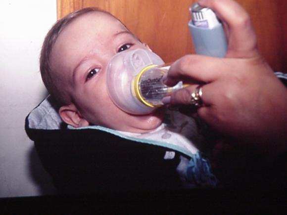 LLegó el pico de bronquiolitis en la provincia de Buenos Aires