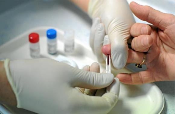 Advierten relajación en los cuidados para prevenir el VIH