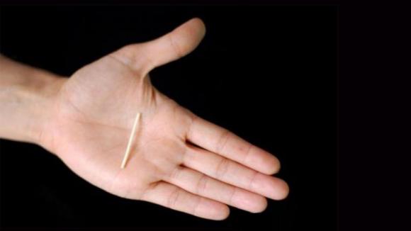 Presentan nuevo anticonceptivo para adolescentes