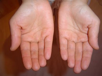 En el hogar las manos comparten más microbios que la nariz