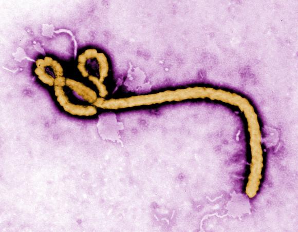 Qué es el virus del Ébola: por qué es tan letal