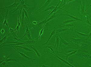 Inédito avance argentino: lograron que cuadripléjicos pudieran ponerse de pie