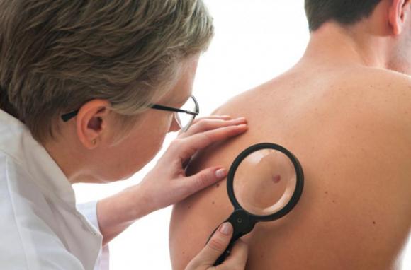 Charla sobre el ¨melanoma¨ en el Hospital de San Isidro