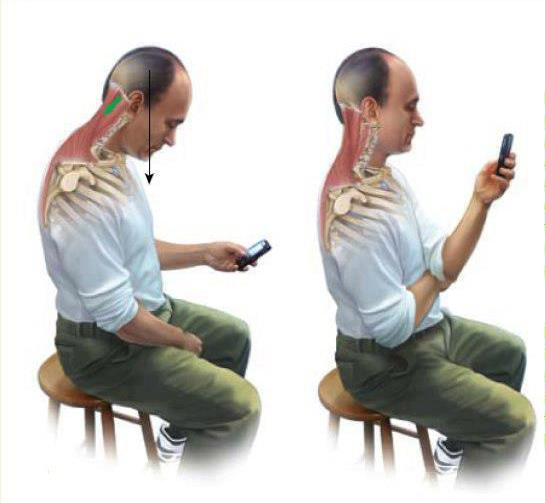 La columna cervical: una víctima de las circunstancias del cuerpo