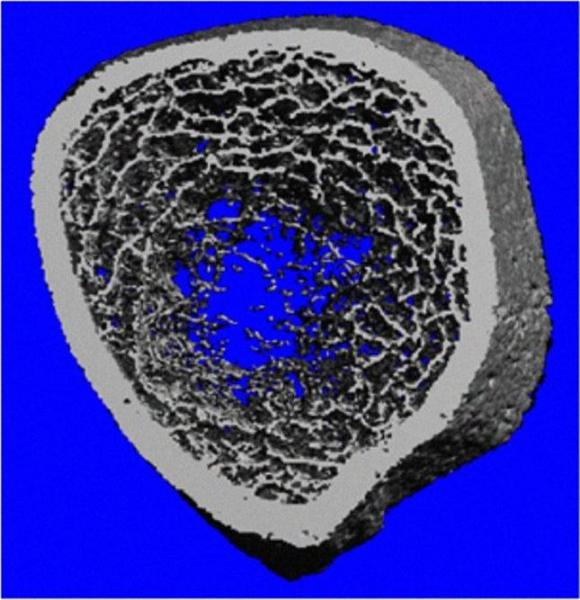 Investigadores Argentinos, reducen el deterioro óseo que produce en las mujeres la enfermedad celíaca