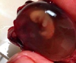 Señores Legisladores, atención integral a la madre y al niño por nacer pero NUNCA la muerte de un inocente