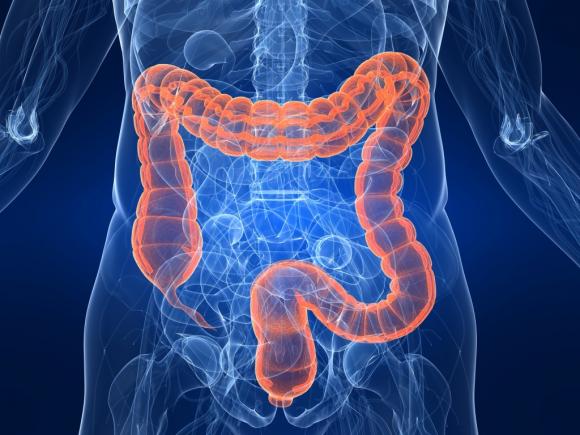 El cáncer de colon afecta a hombres y mujeres por igual