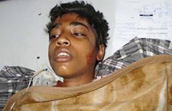 Piden justicia tras la muerte de Nauman Masih, el joven quemado vivo por ser cristiano