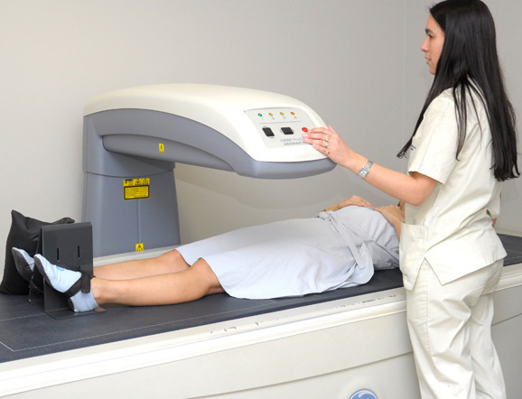 La Sarcopenia  afecta a más de 50 millones de personas 