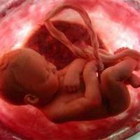 Sí, el niño por nacer siente dolor cuando es abortado