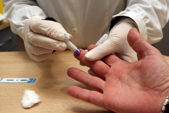 Abren un centro gratuito de testeo rápido de VIH
