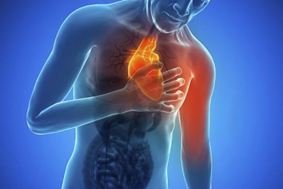 Un análisis de sangre descarta falsos infartos