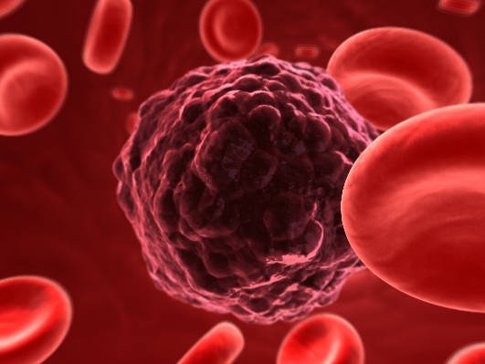 La OMS actualizó el listado de agentes cancerígenos