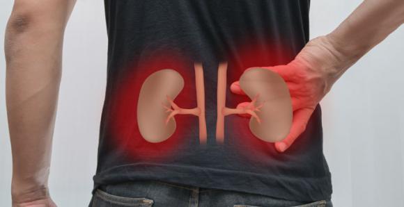 Alertan sobre el aumento de tumores de riñón 