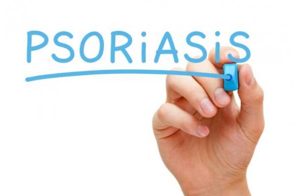 Psoriasis: Modernos tratamientos mejoran la calidad de vida