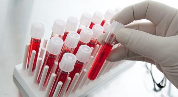 Un análisis de sangre determinaría si un antidepresivo es eficaz 