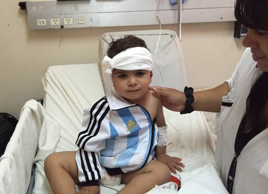 San Isidro: Realizan otro exitoso implante coclear