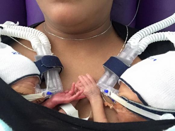 Los adorables mellizos recién nacidos que se toman de la mano cuando están juntos