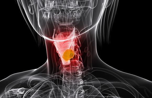 Confirman que el VPH también causa cáncer de garganta