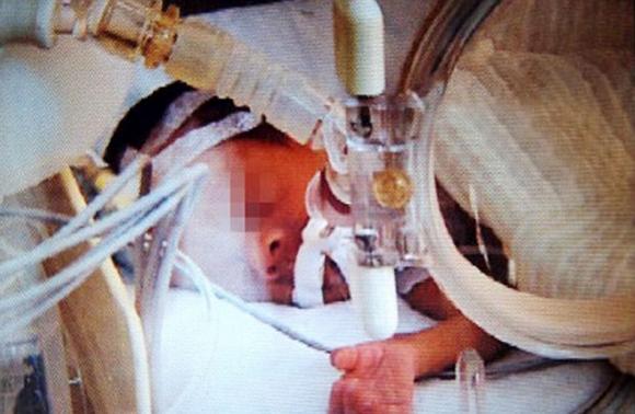 Bebé declarado muerto comienza a llorar antes de ser cremado