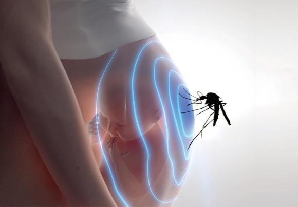 El efecto del Zika sobre el feto podría ser más letal de lo que se pensaba