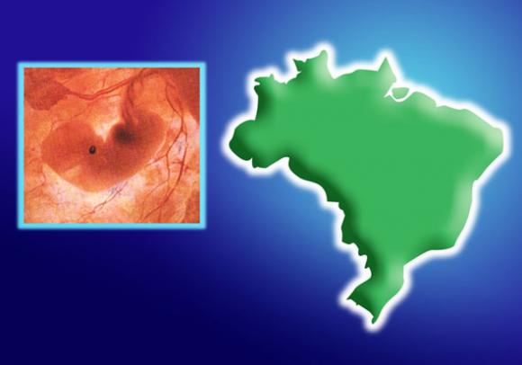 Brasil: mayoría rechaza el aborto en casos de microcefalia