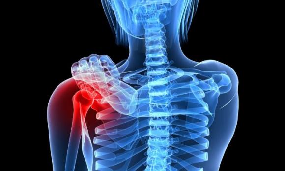 ¿Cómo influye la menopausia en los huesos?