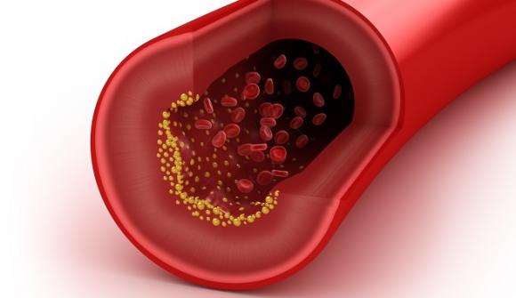 El ‘colesterol bueno’ podría no ser tan bueno